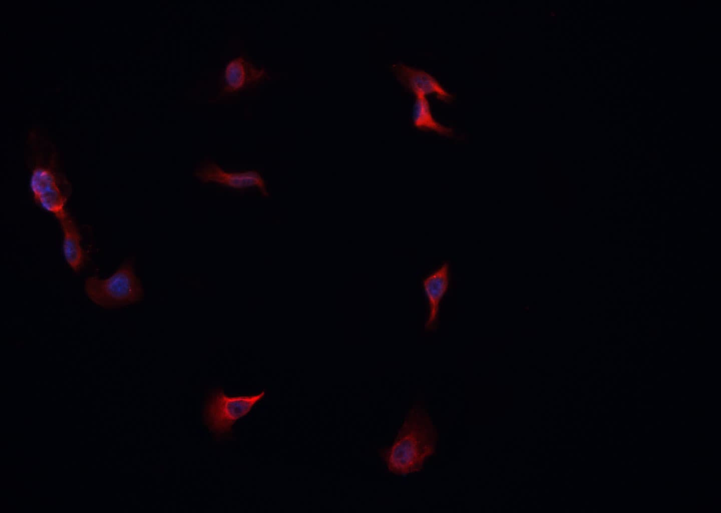 Polyclonal Rabbit anti-Human LRAT Antibody (IHC, IF, WB)