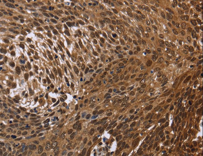 Polyclonal Rabbit anti-Human SMIF / DCP1A Antibody (IHC)