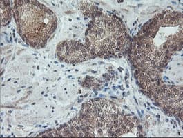RFXANK Antibody (clone OTI2G7)