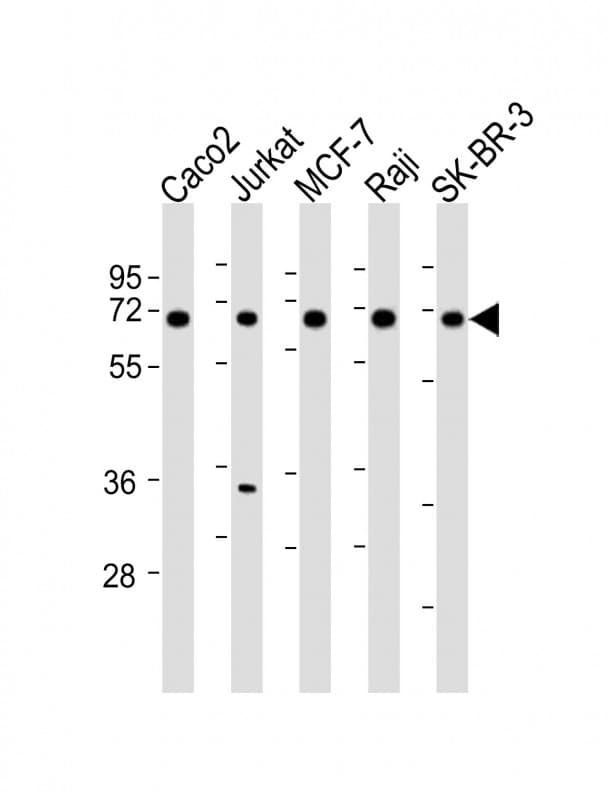 MMP27 Antibody (aa333-367)