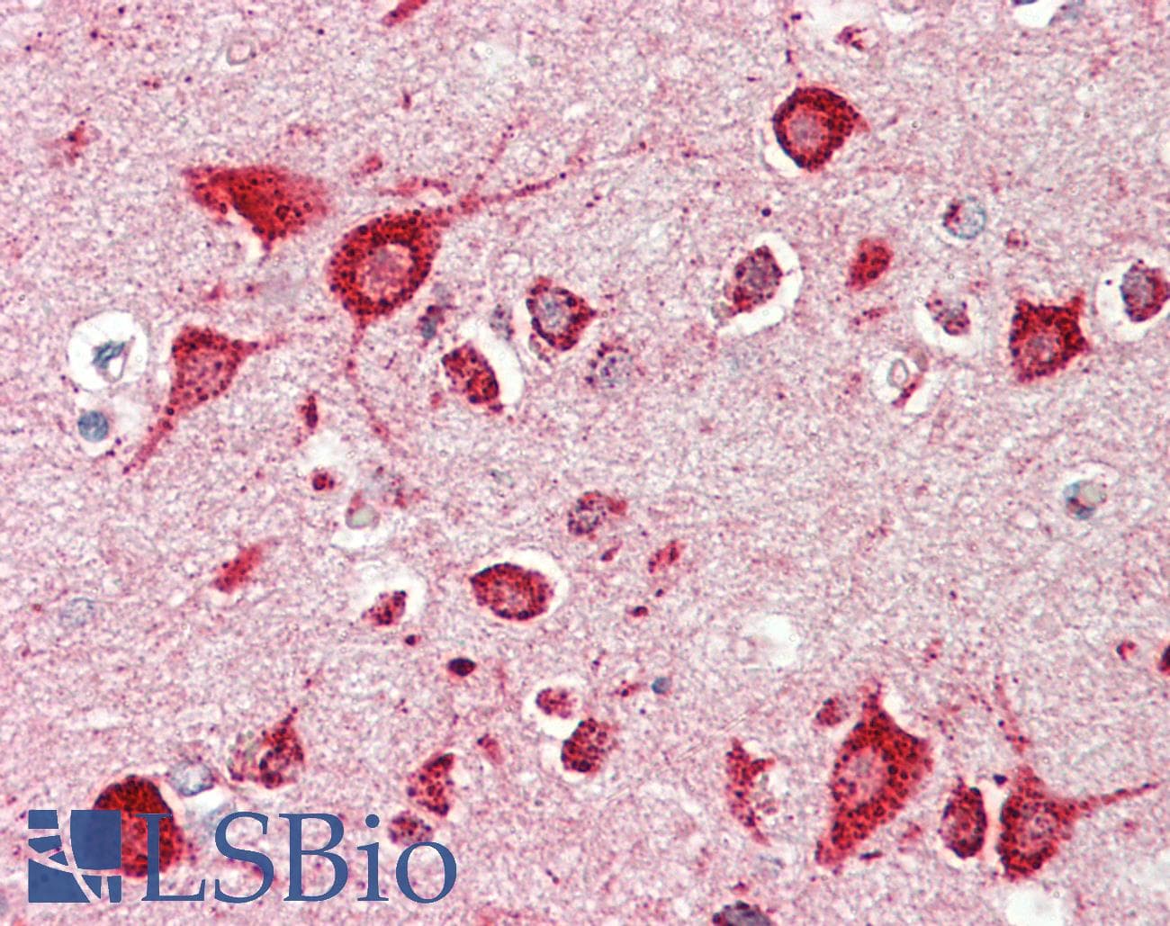 IHC-plus™ MC3R / MC3 Receptor Antibody (aa86-112)