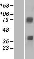 ACSM3 / SAH Protein (Over-Expression Lysate Myc-DDK (Flag))