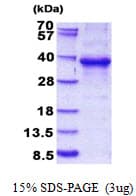 Human ESE3 / EHF Protein (Recombinant His)