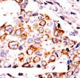 Polyclonal Rabbit anti-Human NME3 Antibody (aa51-81, IHC, WB)