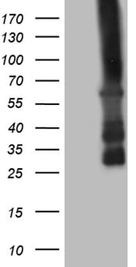 CAMK2B / CaMKII Beta Antibody (aa311-385, clone OTI4G5)