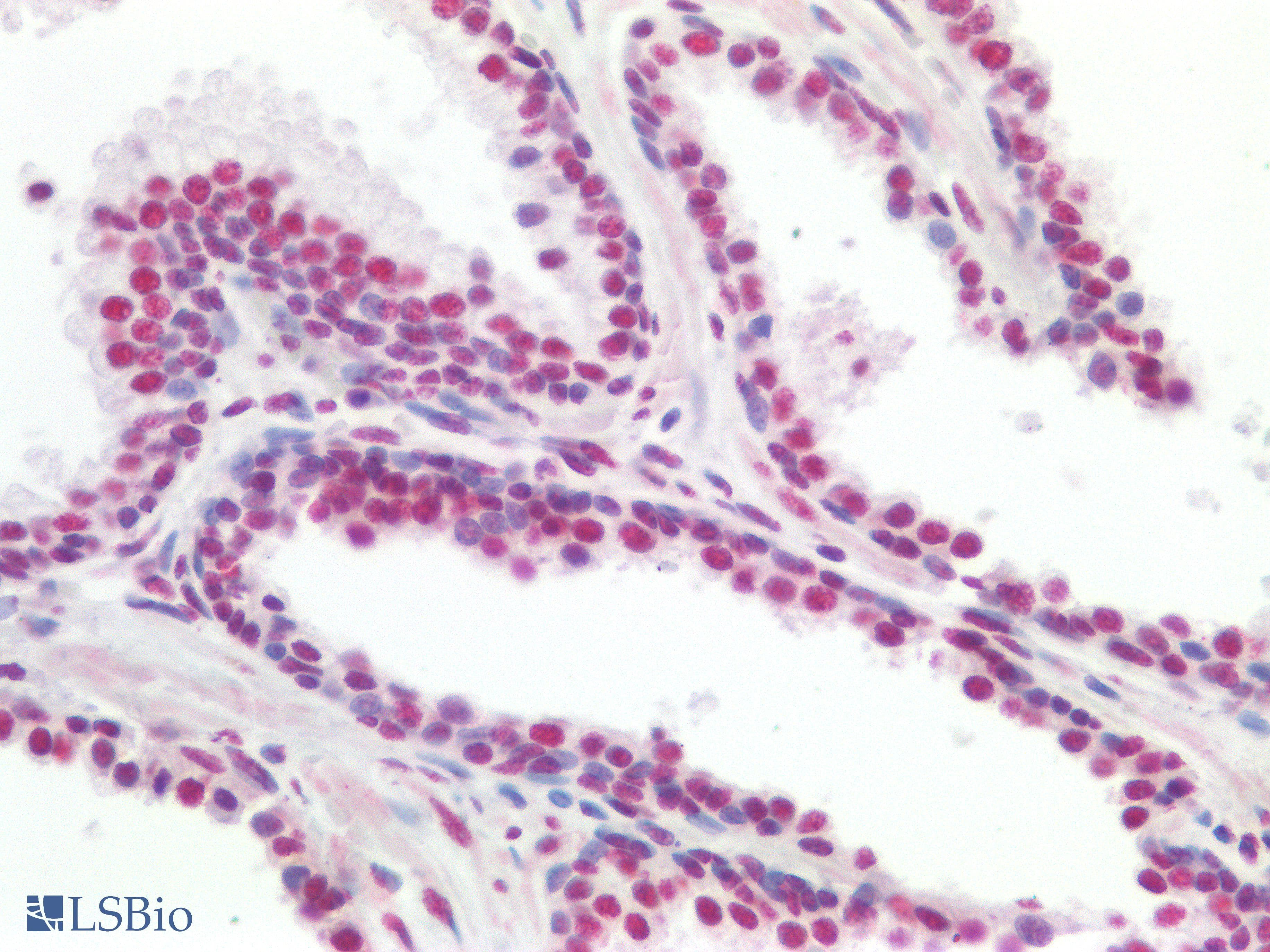 PathPlus™ TDP-43 / TARDBP Antibody (aa337-386)