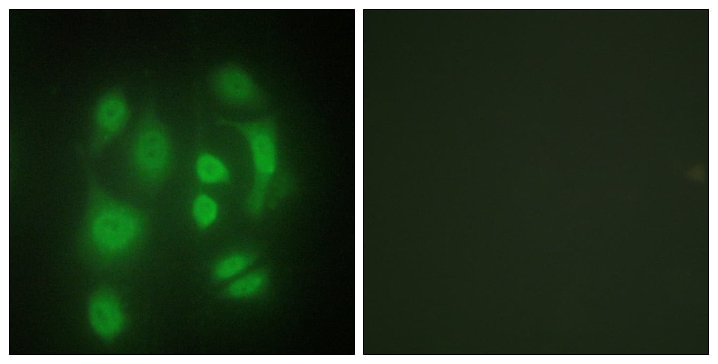 IHC-plus™ Polyclonal Rabbit anti-Human SYNCRIP / HnRNP Q Antibody (aa236-285, IHC, IF, WB)