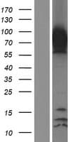 Human Epsin 1 / EPN1 Protein (Over-Expression Lysate Myc-DDK (Flag))
