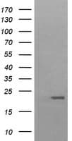 HRAS / H-Ras Antibody (clone OTI1H3)