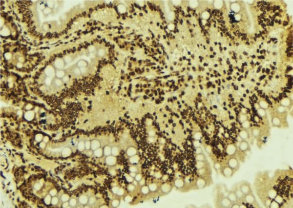 Polyclonal Rabbit anti-Human ZNF71 Antibody (IHC, WB)