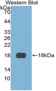 S100A3 / S100E Antibody (aa1-101)