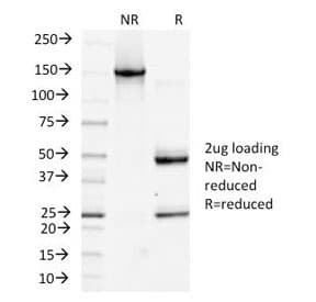 PDPN / Podoplanin Antibody (clone PDPN/1433)