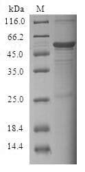 Human FSP27 / CIDEC Protein (Recombinant GST, N-terminus)