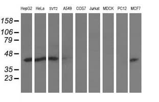 ALS2CR1 / NIF3L1 Antibody (clone OTI2B7)