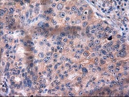KRT18 / CK18 / Cytokeratin 18 Antibody (clone OTI5E8)