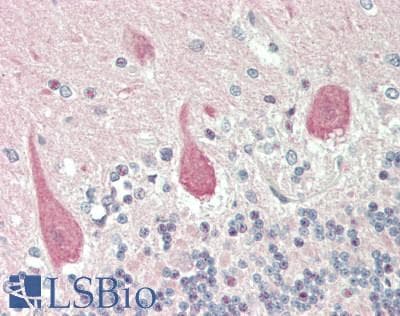 IHC-plus™ NTRK3 / TRKC Antibody
