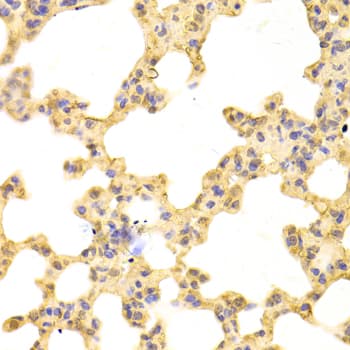 IHC-plus™ Polyclonal Rabbit anti-Human PSMA1 Antibody (IHC, IF, WB)