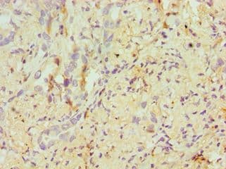 ERCC2 / XPD Antibody (aa1-300)