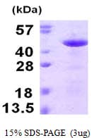 Human RCN3 Protein (Recombinant His)