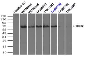 CHEK2 / CHK2 Antibody (clone OTI5C4)