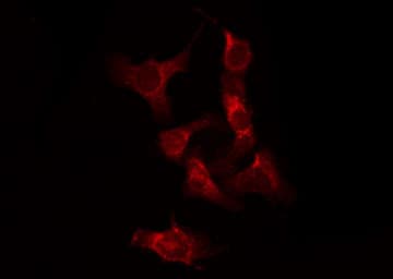 RAF1 / RAF Antibody (phospho-Ser338)