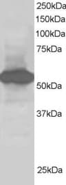 IHC-plus™ Polyclonal Goat anti-Human BAP / SIL1 Antibody (aa448-461, IHC, WB)