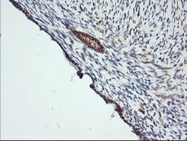 Monoclonal Mouse anti-Human MAP2K1 / MKK1 / MEK1 Antibody (clone OTI3E6, IHC, IF, WB)