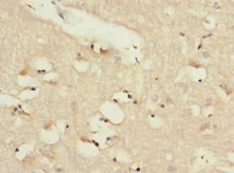 ADGRL2 / LPHN2 Antibody