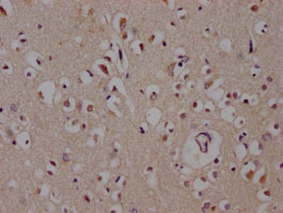 DACT1 / DAPPER Antibody