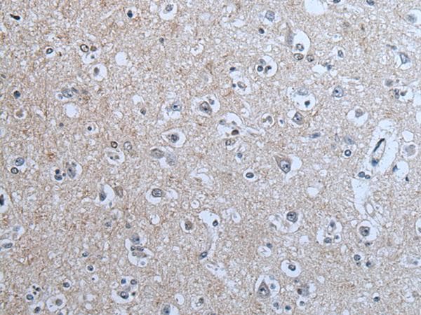 BRSK2 Antibody