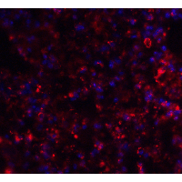 PathPlus™ Polyclonal Rabbit anti-Human AXIN2 / Axin 2 Antibody (IHC, IF, WB)