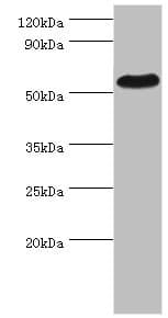 PSEN1 / Presenilin 1 Antibody (aa1-160)