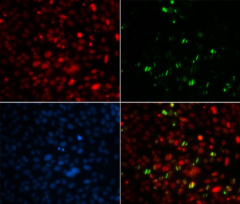 CETN2 / Centrin 2 Antibody