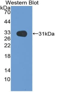 MEP1B Antibody