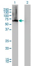 IHC-plus™ Monoclonal Mouse anti-Human AHCYL1 / DCAL Antibody (clone 5D6, IHC, WB)