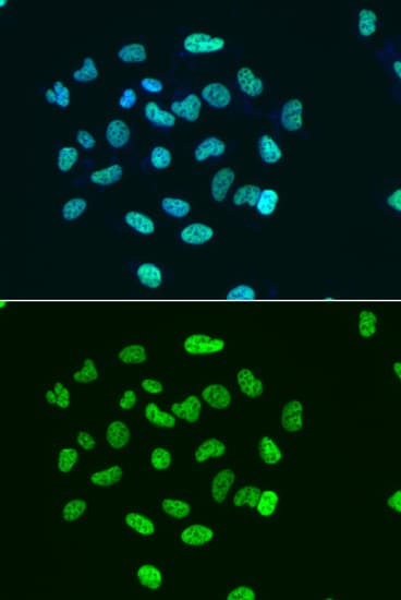 Histone H3 Antibody (Acetyl-Lys9)