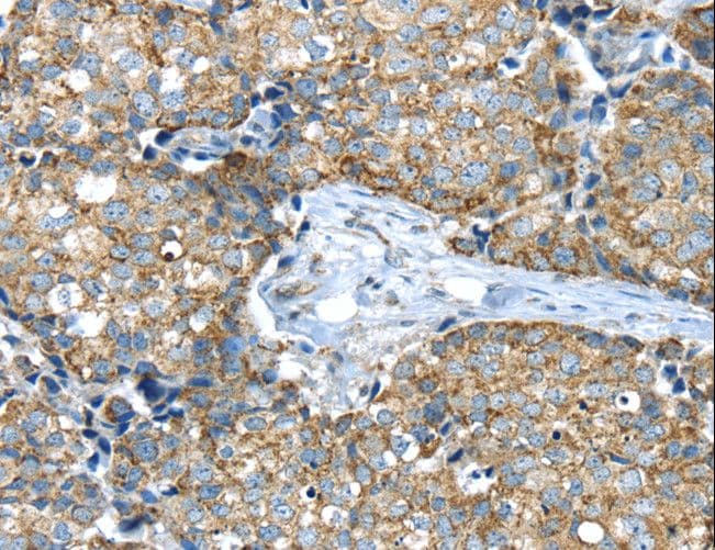 IFNA2 / Interferon Alpha 2 Antibody