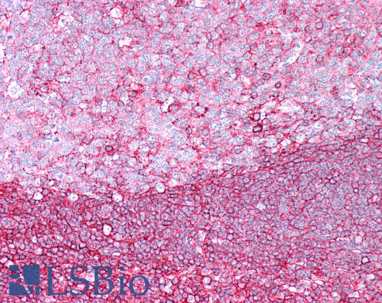 IHC-plus™ CD44 Antibody (clone ABT-CD44)