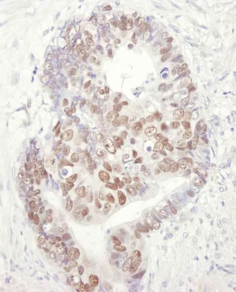 MCM3 Antibody (aa500-550)