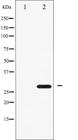 CDKN1B / p27 Kip1 Antibody