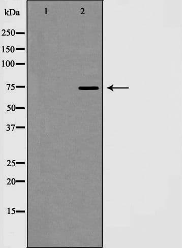 Polyclonal Rabbit anti-Human CDH13 / Cadherin 13 Antibody (IHC, WB)
