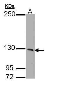 PHKA1 Antibody (aa828-1062)