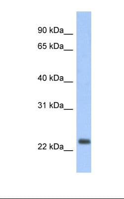Polyclonal Rabbit anti-Human MT-ND6 Antibody (C-Terminus, IHC, WB)