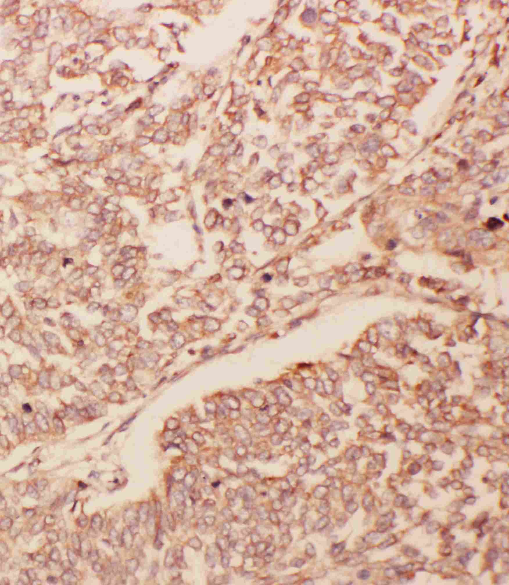 Polyclonal Rabbit anti-Human GDNF Antibody (aa142-158, IHC, WB)
