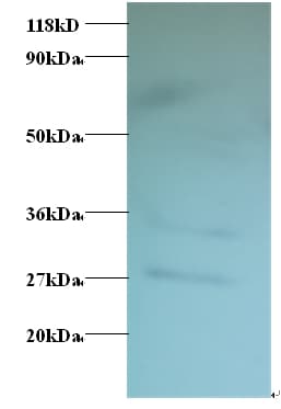 TSTA3 / GDP-L-Fucose Synthase Antibody (HRP)