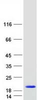 Human NUT2 / MED10 Protein (Recombinant Myc-DDK (Flag))