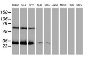 CENPH / CENP-H Antibody (clone OTI2A11)
