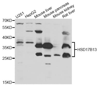 Polyclonal Rabbit anti-Human HSD17B13 Antibody (IHC, WB)