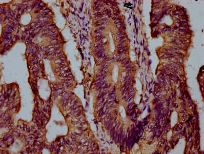 Polyclonal Rabbit anti-Human KIF21B Antibody (IHC)