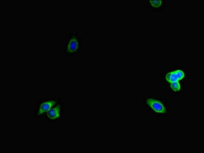 Polyclonal Rabbit anti-Human LTBP4 Antibody (IHC, IF)